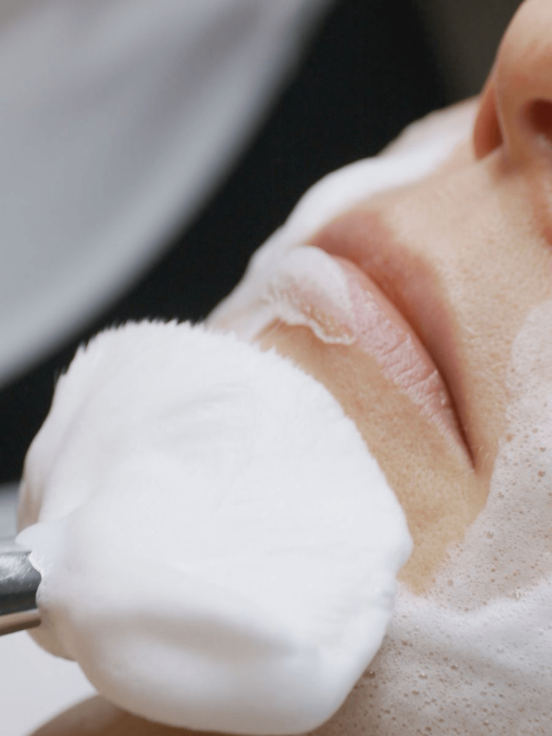 Rose de Mer to profesjonalny peeling koralowy przeznaczony do intensywnej regeneracji skóry, redukcji blizn potrądzikowych oraz poprawy jej struktury.