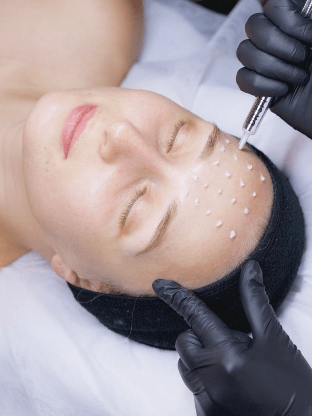 Dr Esthe SPI-CURE to innowacyjny zabieg ze spikułami gąbki morskiej